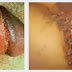 Harga Obat Kutil Kelamin Ampuh Pada Pria thumbnail