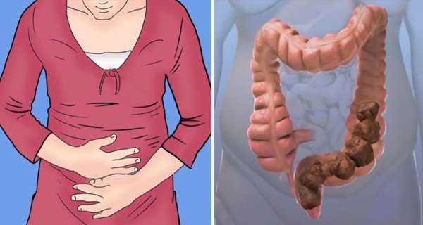 Here Is What Causes Constipation And Natural Ways To Get Rid Of It! Causes Constipation And Natural Ways To Get Rid Of It!