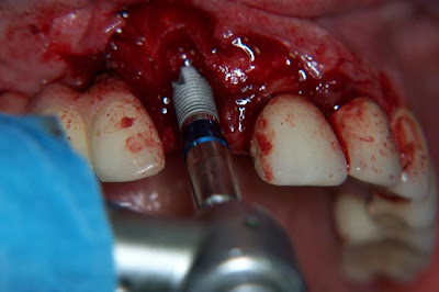 INTEGRACION QUIMICA ODONTOLOGIA integracion quimica odontologia: