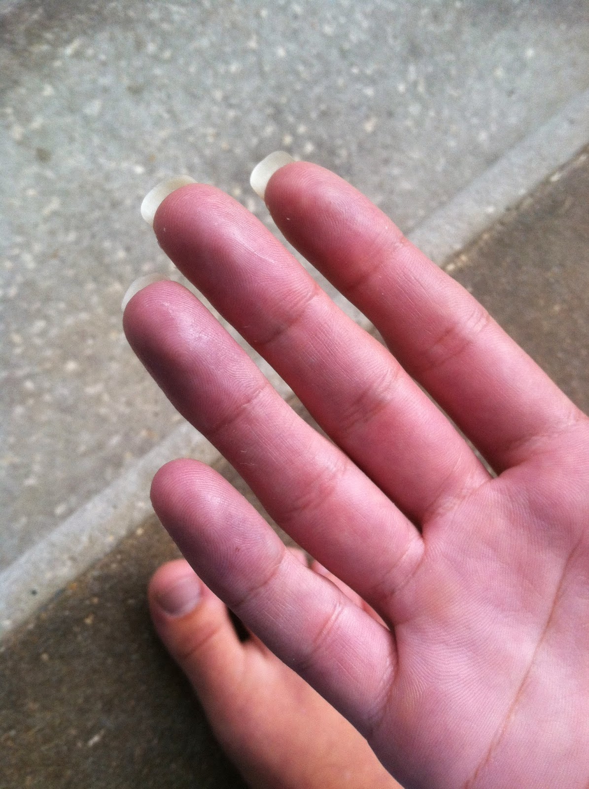 My Life With Ehlers Danlos: At home mom, Part time student, Full time