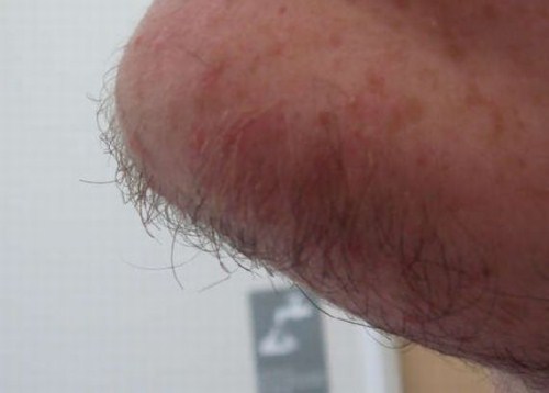 http://4.bp.blogspot.com/-wwCGCxJn_hk/TfCVhZJsX6I/AAAAAAAAG_I/kH-FVbt0dB4/s1600/Some%2BEasy%2BBut%2BDangerous%2BWay%2BOf%2BShaving%2B%25285%2529.jpg