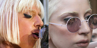 Celebrity Before And After Plastic Surgery Lady Gaga Nose Job Plastic Surgery Facelift Before And After