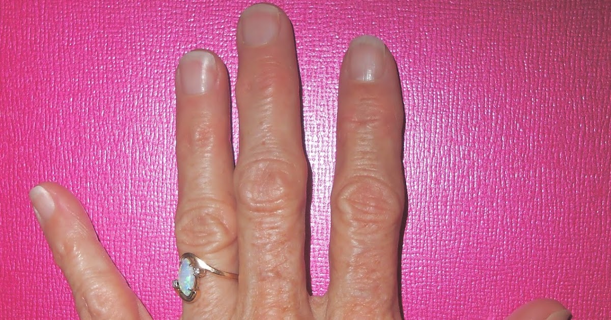 My Sister's Garden Got Ugly Hands?