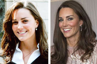 middleton kate before after nose surgery plastic job profile botox princess her she royal face hair work famous age transformation