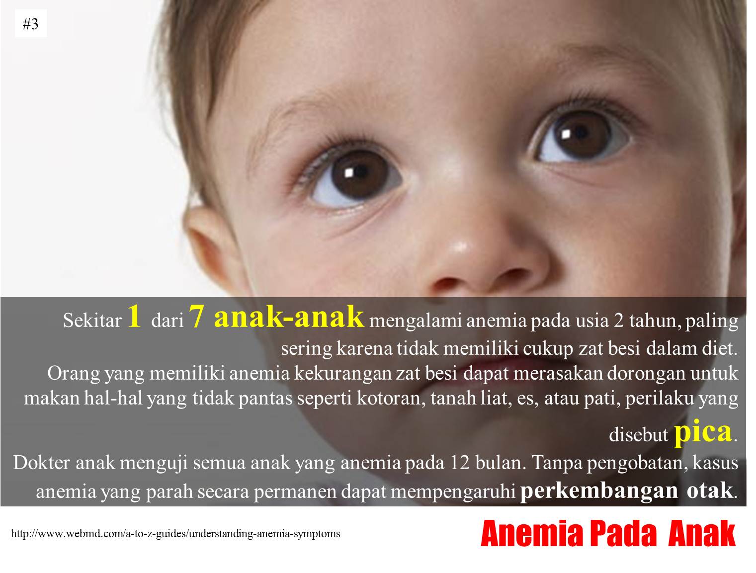 ANEMIA GIZI