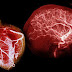 El Corazón tiene neuronas como las del cerebro
