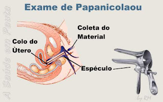 Exame de Papanicolau. Prevenção contra o câncer de colo de útero.