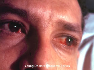 Purulent surgery essays 05 picture