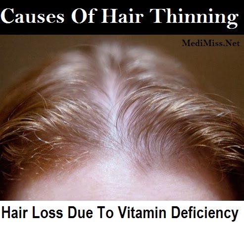 que faire pour eviter les vergetures enceinte 1 mois