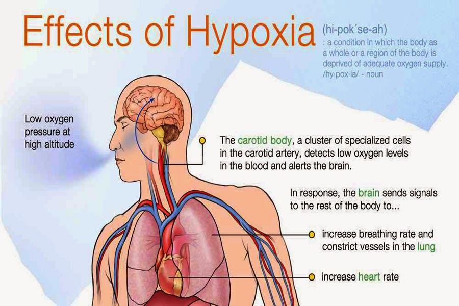 Hypoxia And Classify of Hypoxia, Asphyxia the types with causes of