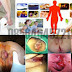 Bebas Wasir dengan Ambeclear dan Salep Salwa thumbnail