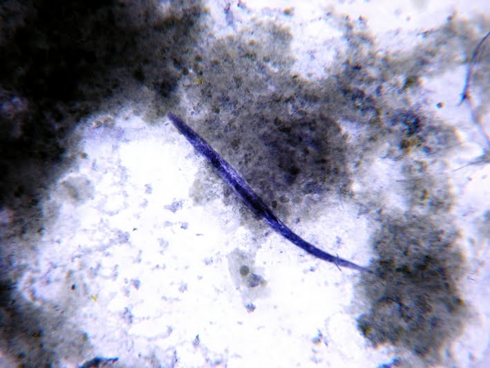 Fun With Microbiology (What's Buggin' You?): Strongyloides stercoralis