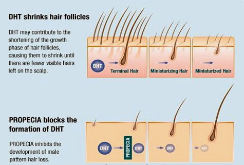 Acheter Du Propecia En Pharmacie
