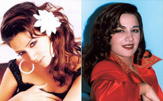 صور الفنانات قبل وبعد عمليات التجميل صور الفنانات قبل وبعد عمليات التجميل