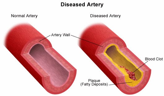 how to strengthen blood vessels how to strengthen blood vessels