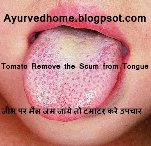 Scums Accumulating on the Tongue cure with Tomato  जीभ पर मैल जम जाये तो टमाटर करे उपचार  Jeeb Par Maill Tamatar Se Theek Kare