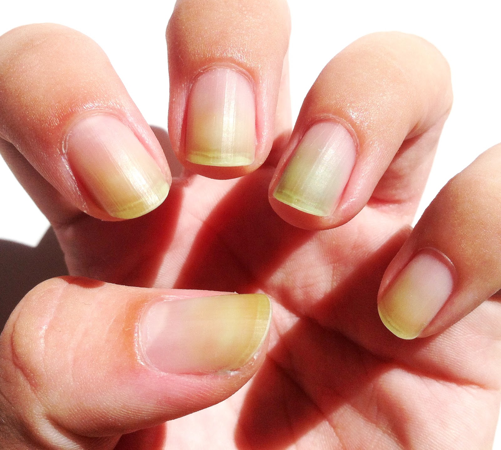 Beeindruckend Gelbe Nägel Wegen Nagellack Schellack Kaufen Naegel Schoene Herbst 2018