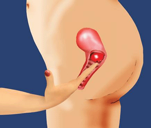 Cervix Women