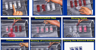 Red Princess Pewarnaan Bakteri Tahan Asam Bta