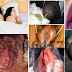 Informasi Obat Selain Ciprofloxacin 500 mg Untuk Kemaluan Bernanah thumbnail