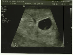 Ultrasound at 6 weeks and 3 days