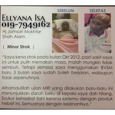 testimoni biovelocity sleepmate dari pengidap minor strok kembali sembuh
