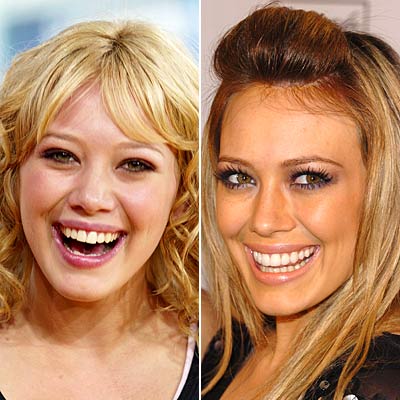  Plastic Surgery    on Hilary Duff  A Tale Of Plastic Surgery   How To Be Lovely