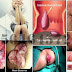 Cari Obat Wasir Yang Lebih Bagus Dari Ambeven thumbnail