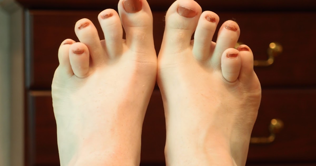 cute sandals for ugly feet