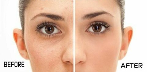 PETUA MENEGANGKAN KULIT MUKA PETUA MENEGANGKAN KULIT MUKA