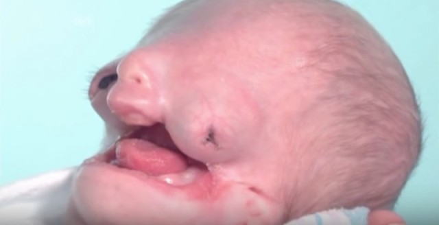 a baby born with disfigured body found a helping family