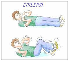 epilepsi epilepsi