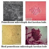 ORGAN TUBUH MANUSIA: NON DERMATOFITOSIS