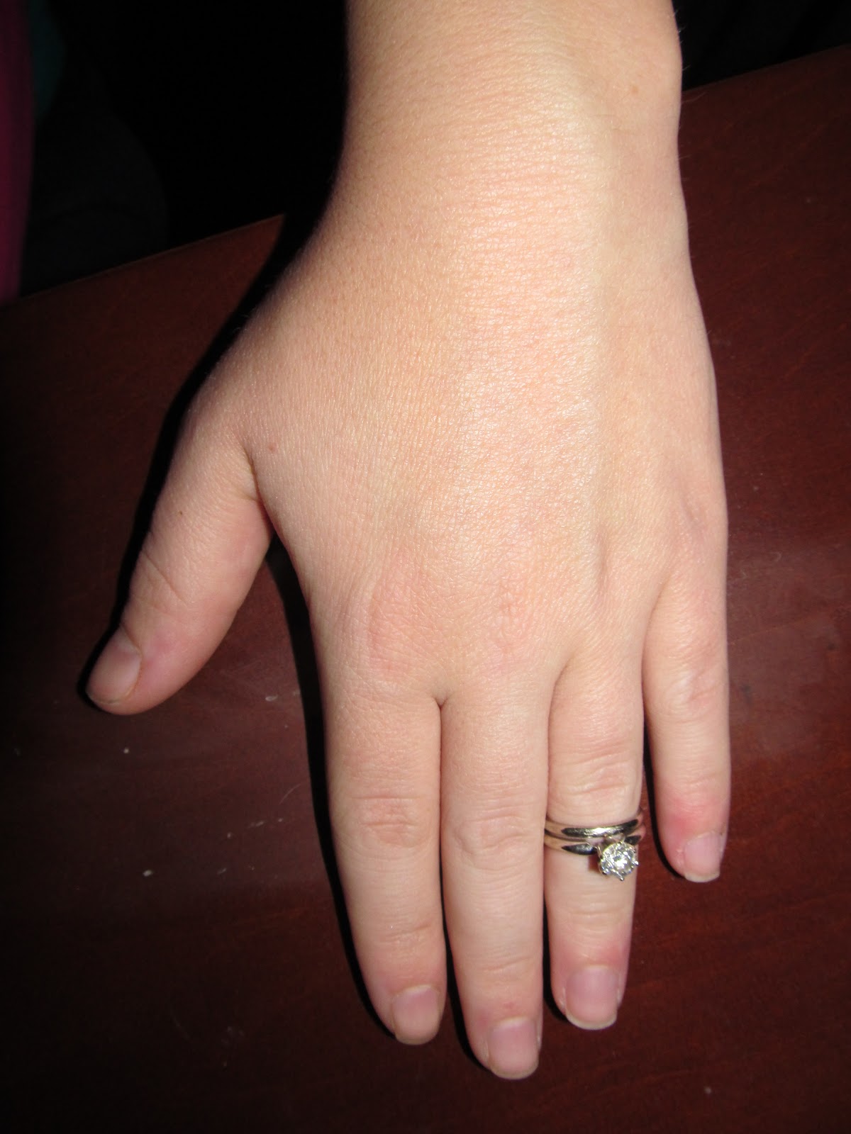 Wedding ring tight during pregnancy