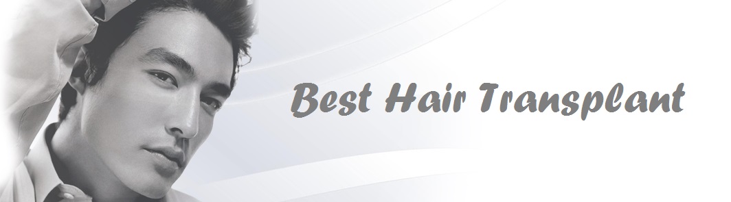 Best Hair Transplant Phoenix - Revive Hair Restoration Phoenix AZ