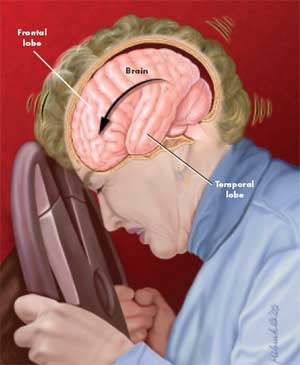 Finally, A Blood Test for Traumatic Brain Injury