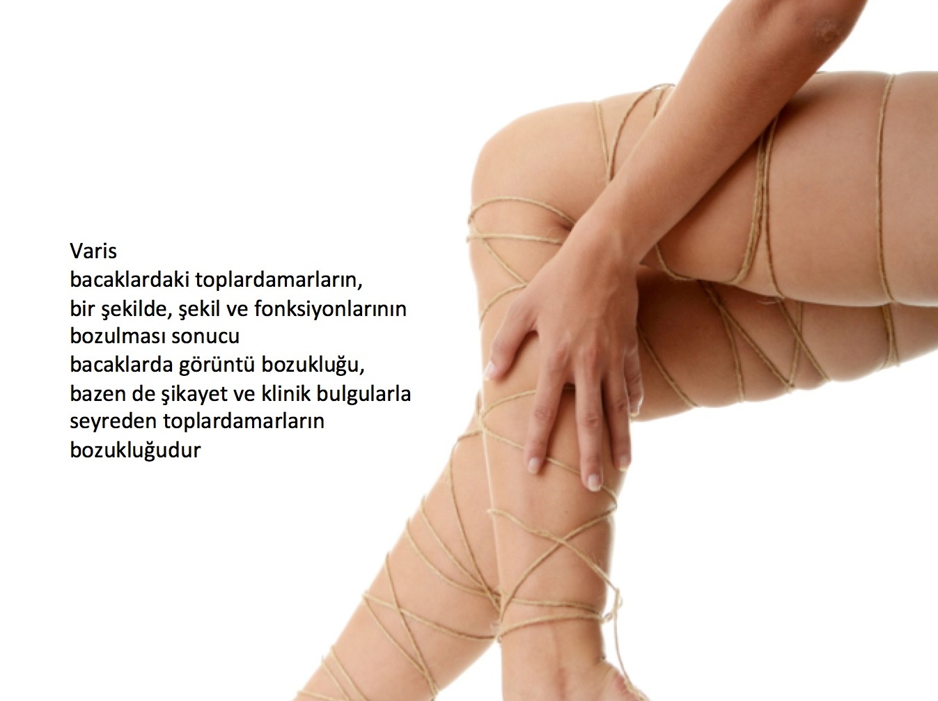 Varis Tedavisinde Neler Yenmeli-Varise Bitkisel Çözüm Varis Tedavisinde Neler Yenmeli-Varise Bitkisel Çözüm