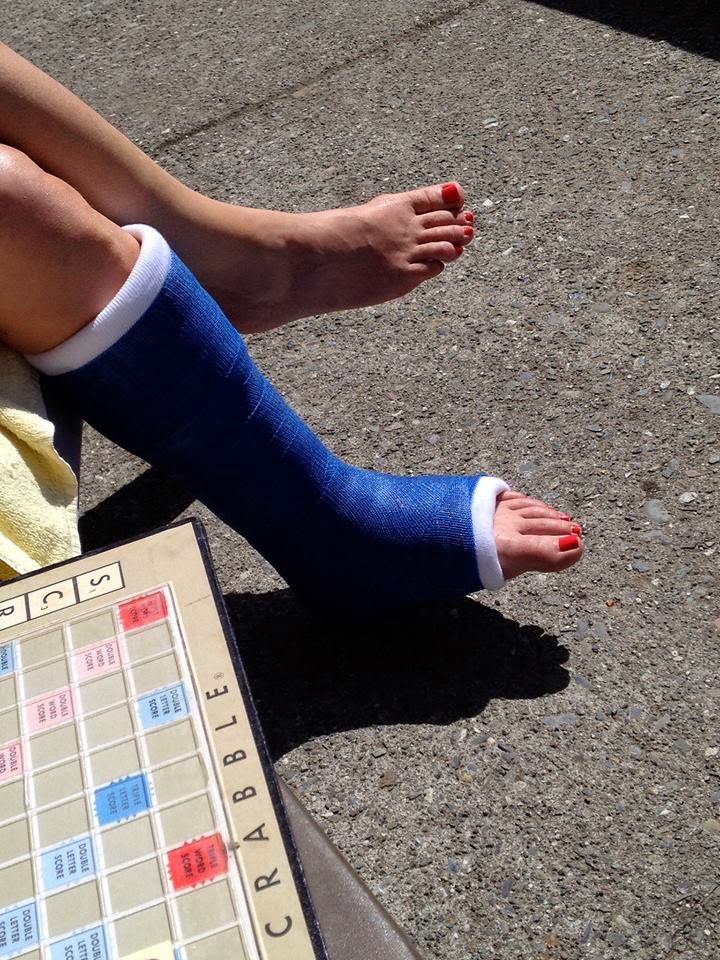 castgirls playful toes blue short leg cast