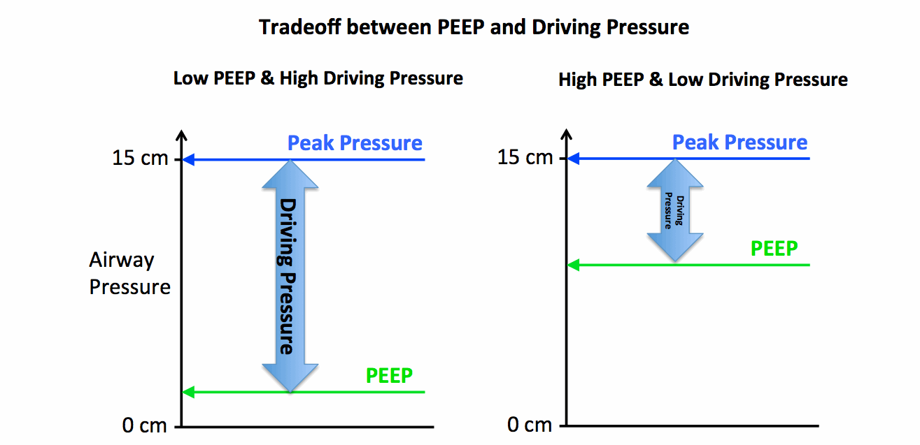 Apneic ventilation using pressurelimited ventilation