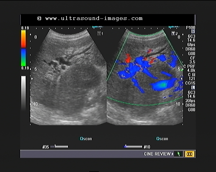 Sonography case study image