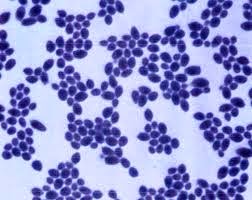 Gambar jamur candida Gambar jamur candida