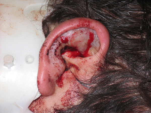 ear hematoma ear hematoma breeds picture ear hematoma ear hematoma breeds picture