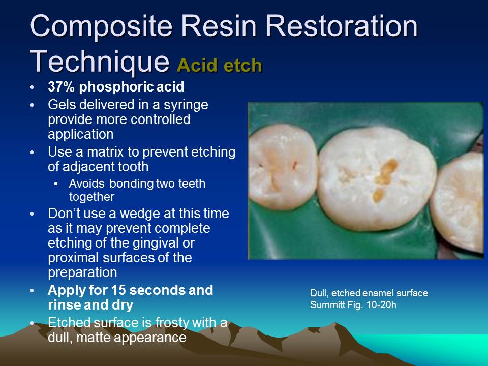Dentistry Composite Resin