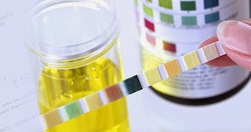 Infirmiers en oncologie: Comment interpréter les résultats Infirmiers en oncologie: Comment interpréter les résultats