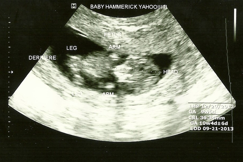 Adventures of Allie: Third Month of Pregnancy