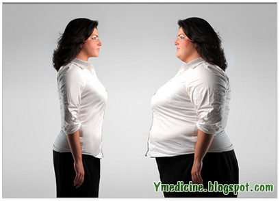 Obesity or overwieght Obesity or overwieght
