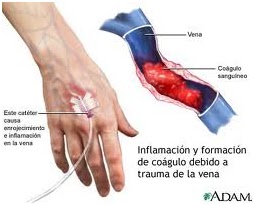 La trombosis aguda de las venas inferior