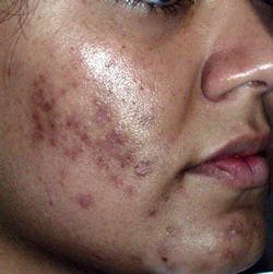 What are some possible causes of skin discoloration?