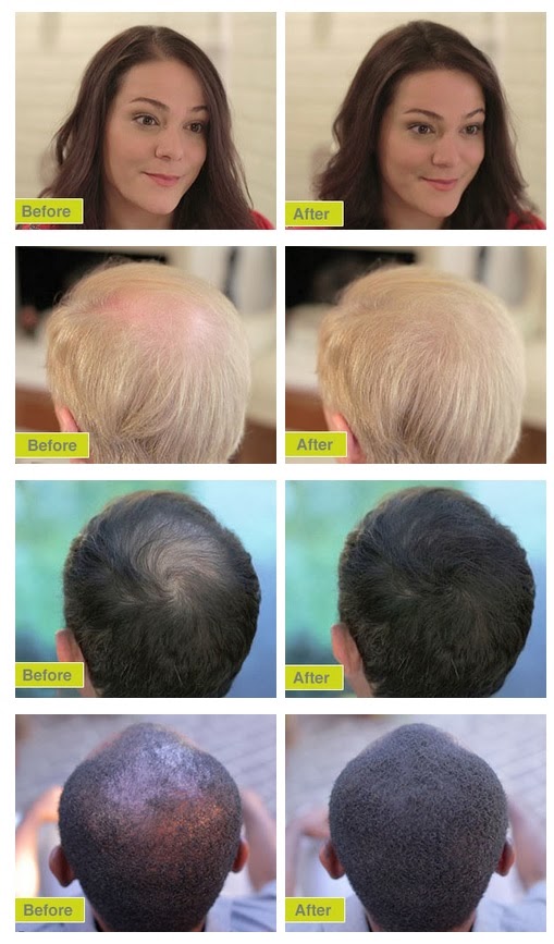 Temporary Waffle Focus Hair Building Fibers Review