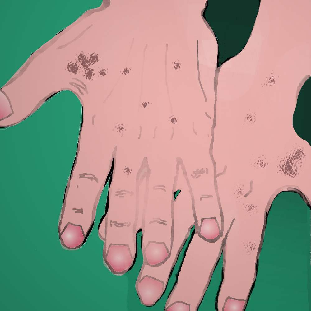 La crema da pigmentary nota su un corpo in una farmacia
